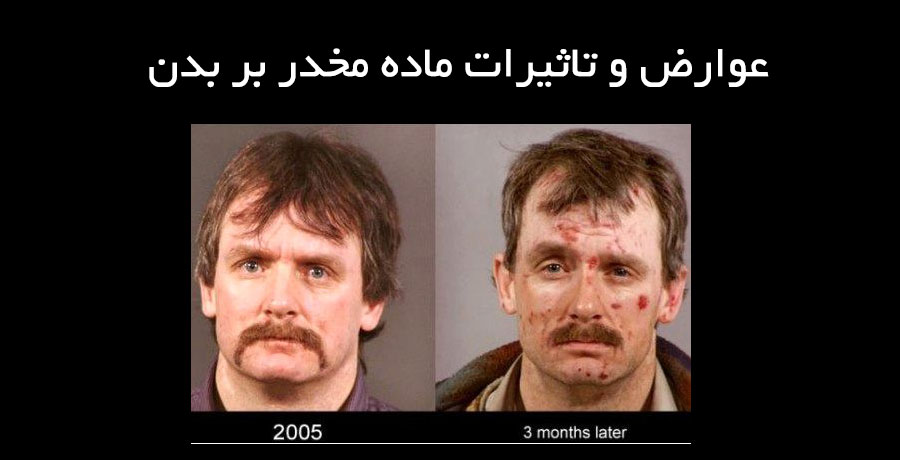 عوارض و تاثیرات ماده مخدر بر بدن